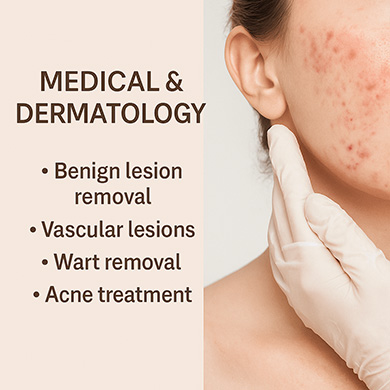 Benighn lesion removal, vascular lesions, wart removal, acne treatment with Fotona laser